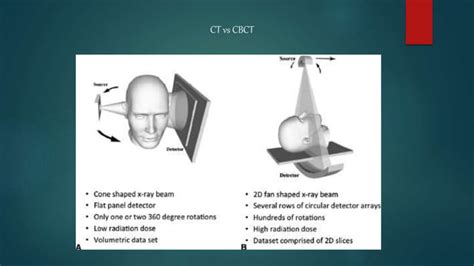 ct vs cbct|dental cbct machines comparison.